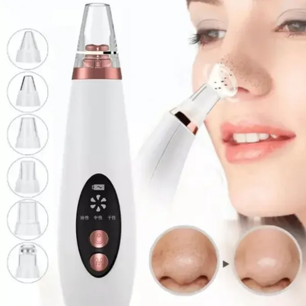 Removedor De Cravos Espinhas Cleaning Sugador Poros Acne Sucção Usb Recarregável