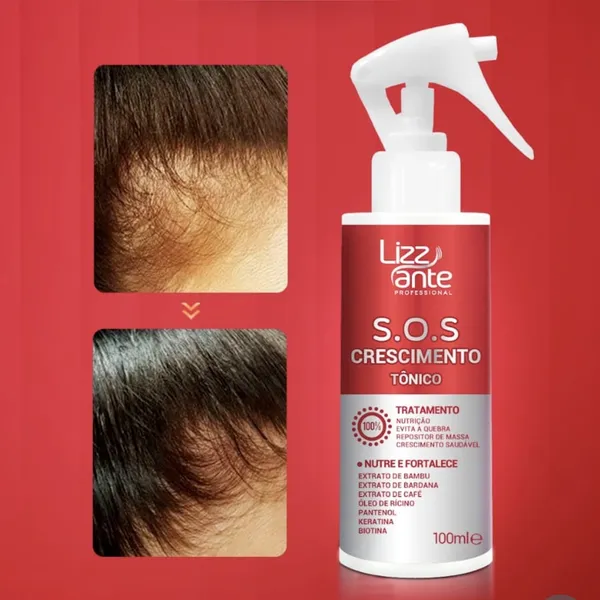 Tônico SOS Crescimento 100ml Lizz ante Crescimento Acelerado Preenche Falha Aumenta Volume do Cabelo
