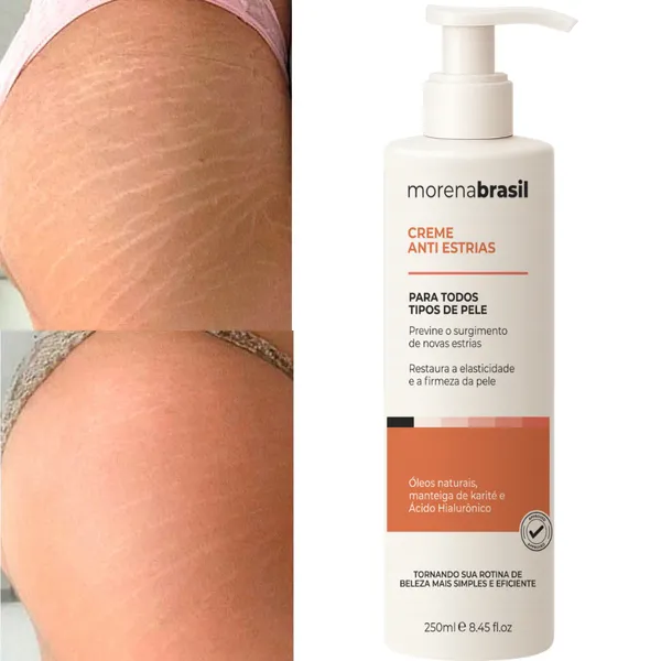 Creme Antiestrias Morena Brasil 200g – Com Colágeno e Elastina