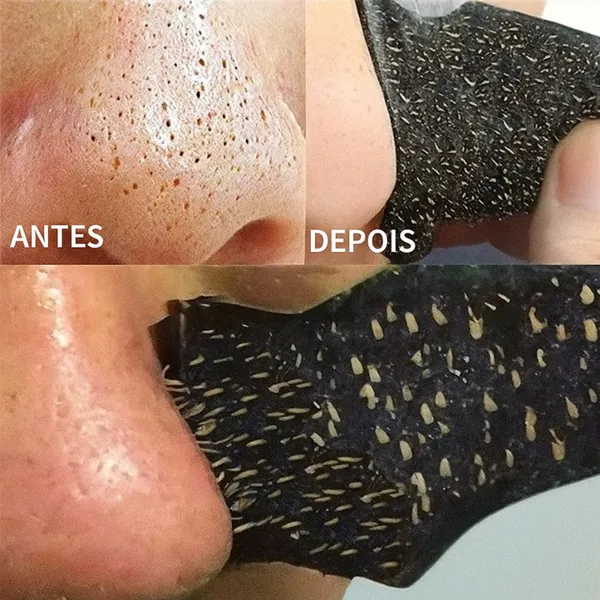 Kit 10 Máscaras Adesivas Removedoras de Cravos à Base de Carvão de Bambu para Limpeza Profunda dos Poros